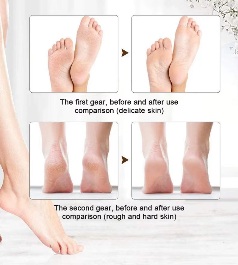 Rechargeable Electric Callus Remover Cordless Women Men Electronic Foot File Removes Dry Coarse Skin...